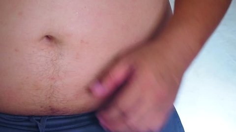 a fat man scratching the belly with hand. red spots on skin, allergies, psoriasis, insect bite. sunburn. motion b-roll footage
