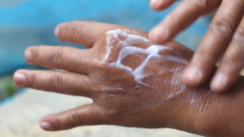 Young woman applying cream on hand against, to dry flaky skin as in the treatment of psoriasis, eczema and other dry skin conditions