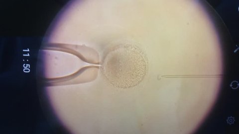 A female egg under a powerful microscope is fertilized by a sperm cell. Under a microscope, a sperm is injected into the female ovum. birth of children. Conception of a child. Syringe and sperm