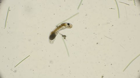 rotifer Notommata, family Nototamidae similar to a worm, under a microscope