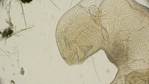 an oligochaete intestinal worm with a large open mouth in motion, under a microscope