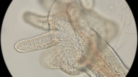 the back of the worm Oligochaeta Aulophorus, where there are gill-like outgrowths similar to the arm, allowing it to breathe, under a microscope