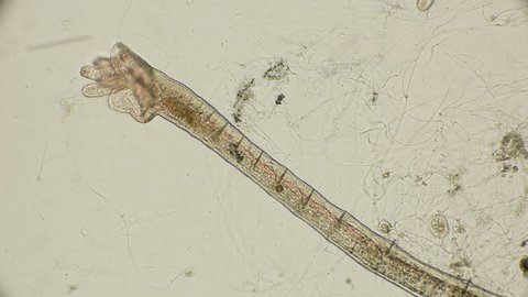 defecation of Oligochaeta worm Aulophorus, under a microscope