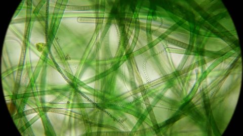 movement of live algae under a microscope