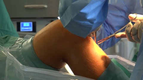 Knee Surgery and Anterior Cruciate Ligament. The anterior cruciate ligament (ACL) is one of a pair of cruciate ligaments (the other being the posterior cruciate ligament) in the human knee. 