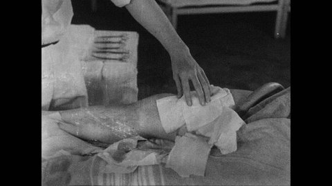 1930s: UNITED STATES: doctor remove splint from patient's leg. Doctor cleans around wound. Doctor shaves hair around wound.