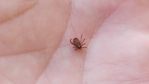 Bloodsucking insect. mite. insect on a human palm lies on its back. tick hold tweezers.