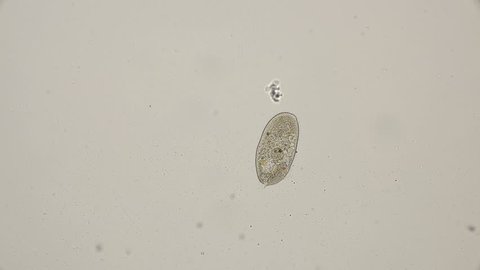 Ciliate Stentor Free Swimming Under Microscope Stock Footage Video (100 ...