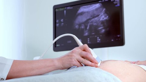 In the Hospital, Close-up Shot of the Doctor does Ultrasound / Sonogram Procedure to a Pregnant Woman.