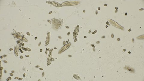 colony of ciliates Coleps, prey on bacteria, which are very much in dirty water, under a microscope