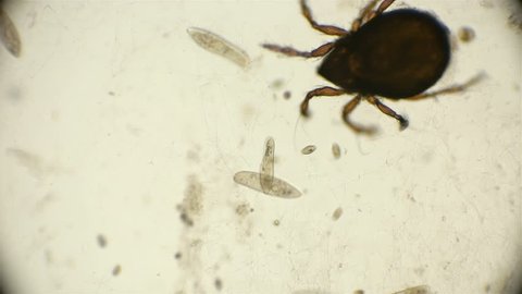 Arthropoda mite Arachnida living in reservoirs, as well as in the soil, under a microscope