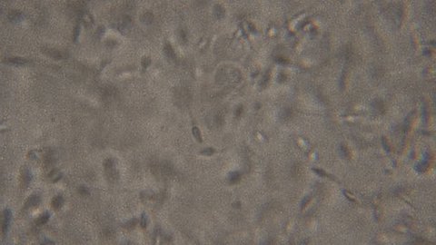 Sperm (spermatozoa) viewed under the microscope. Moving human sperm under Phase contrast Microscope, medium magnification,