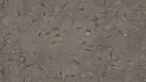 Sperm (spermatozoa) viewed under the microscope. Moving human sperm under Phase contrast Microscope, medium magnification,