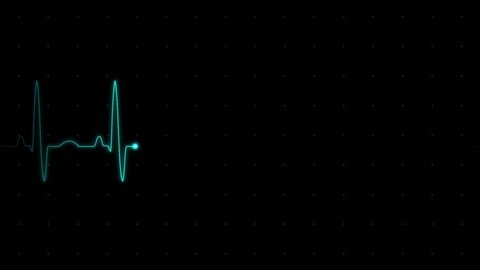 Electrocardiogram heart rate on the screen of medical equipment 1920x1080p