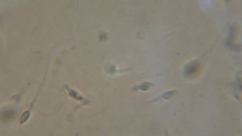 Sperm (spermatozoa) viewed under the microscope. Moving human sperm under Phase contrast Microscope. Close up showing spermatozoons. 