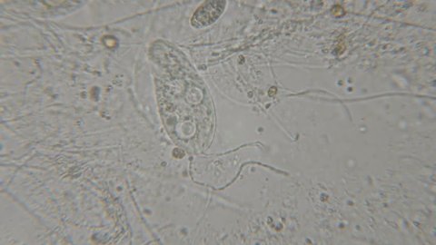 Motion of single-celled animals (infusoria) under microscope. Colony of ciliates Stylonychia under the microscope in lake water. 