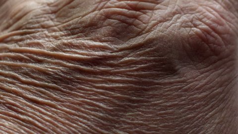 Close up of Senior's hands with Alzheimer disease