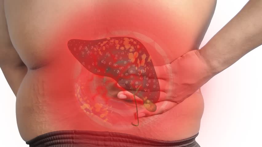 Liver pain, liver cancer, hepatitis, has lightning and red means pain. | Shutterstock HD Video #1020482497