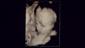 4d scan Pregnant Ultrasound of a baby fetus at 23 weeks 