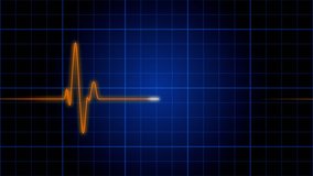 EKG: An electrocardiogram heart monitor pulses on a blue grid (Loop).