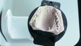 Dental prosthesis scanner. HD video