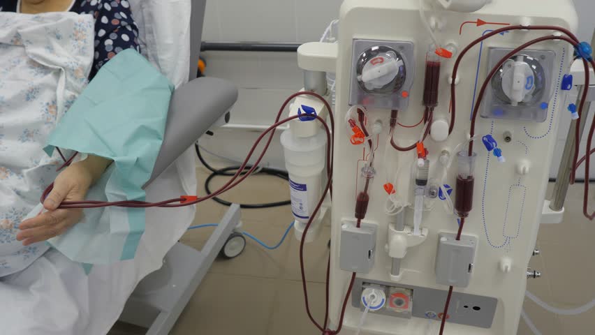 Hemodialysis. Machine artificial kidney