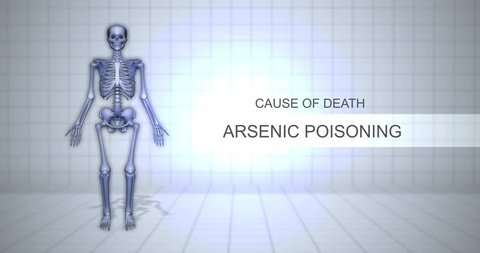 Human Forensic Autopsy Animation Concept - Cause of Death - Arsenic Poisoning