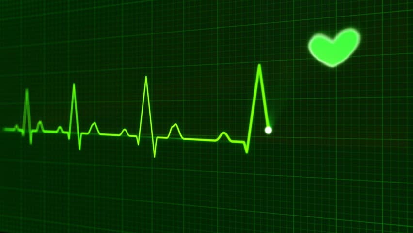 royalty-free-vector-of-ekg-an-electrocardiogram-the-25556933-stock