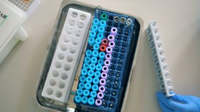 A person puts blood samples on a rack in a laboratory, top view. - Powered by Shutterstock - Get 15% off with code: PIKWIZARD15