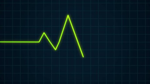 Green heartbeat pulse rhythm on electrocardiogram, healthcare concept ECG or EKG cardiology