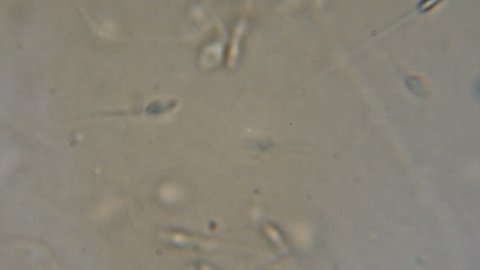 Sperm (spermatozoa) viewed under the microscope. Moving human sperm under Phase contrast Microscope. Close up showing spermatozoons. Video semen under microscope. 4K UHD
