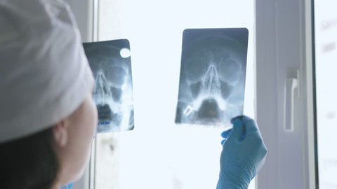 Female doctor compares 2 x-rays against the window.  View from the shoulder. - Βίντεο στοκ