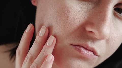 Close-up of a woman's face. The girl touches the fingers of problem skin with enlarged pores, examining it. The concept of caring for problem skin, aging, environmental effects on the skin.