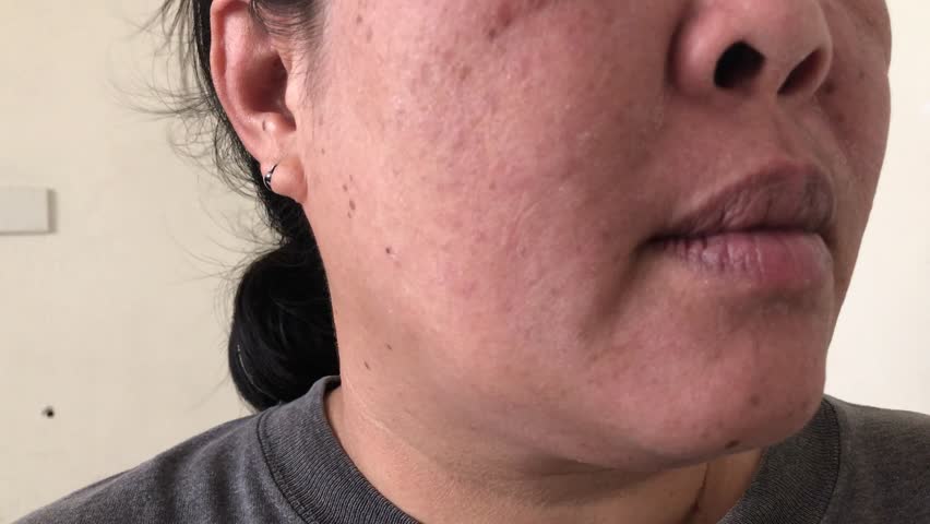 irritated skin on face