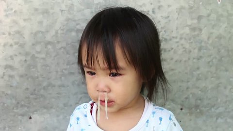 Close up Mucus flowing from nose of little Asian girl. child has a runny nose with clear snot.
