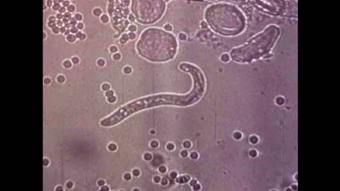 CIRCA 1940s - The parasite Trichonisis feeds on flesh and blood under a microscope in the 1940s