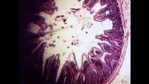 CIRCA 1940s - The parasite Trichonisis under a microscope begin reproducing in the 1940s