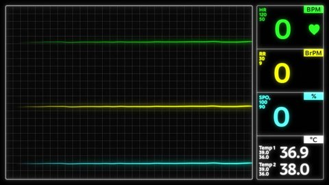 Stylized EKG Flatline, Green. Close up on pixelated heart rate monitor screen / electrocardiogram (EKG or ECG) beeping then flatlines. Shallow depth of field 4k