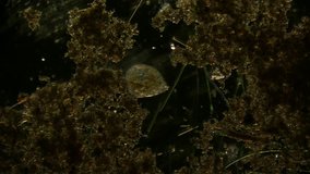 microorganism under the microscope video clip