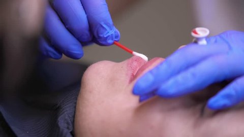 Lip treatment, preparation of lips for applying permanent makeup (tattoo)