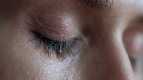 The female eye cries and tears are flowing macro video. Close-up woman eye cries and tears flow. 4k. Macro shoot.