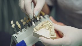 A doctor in latex gloves is holding in his hand an cast of the jaw with teeth and selecting crowns with a similar shape on the blurred background. Close-up.