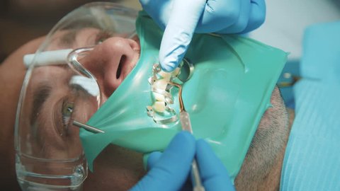 Dentist treating a patient using cofferdam. 4K.