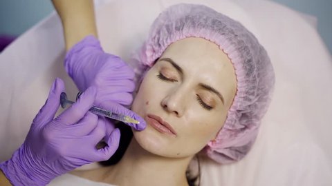 A beautician in gloves makes injections to the upper and lower parts of the lips of a young woman. Close-up.
