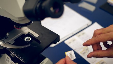 A scientist preparing a slide of his own cancer cells from a medical biopsy on a microscope in a medical research science lab.