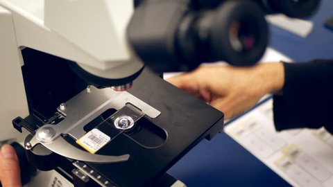 A scientist focusing on a slide of cancer cells from a medical biopsy on a microscope in a medical research science lab.