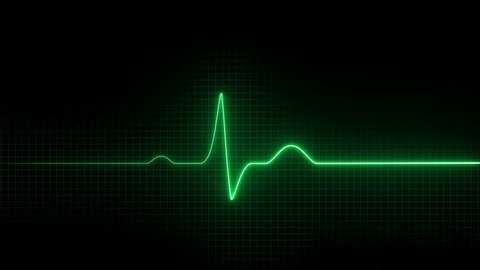 Cardiogram. Electro cardiogram 
