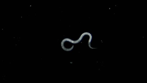 nematoda worm, parasite, pest and fish food, under a microscope