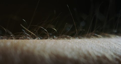 Slow motion macro of hair raising goose bumps on man arm skin caused by some strong emotions. Shot in 8K.