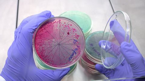A scientist opens a Petri dish and examines red bacteria. Analysis of bacteria in a Petri dish. Bacteria red on agar.